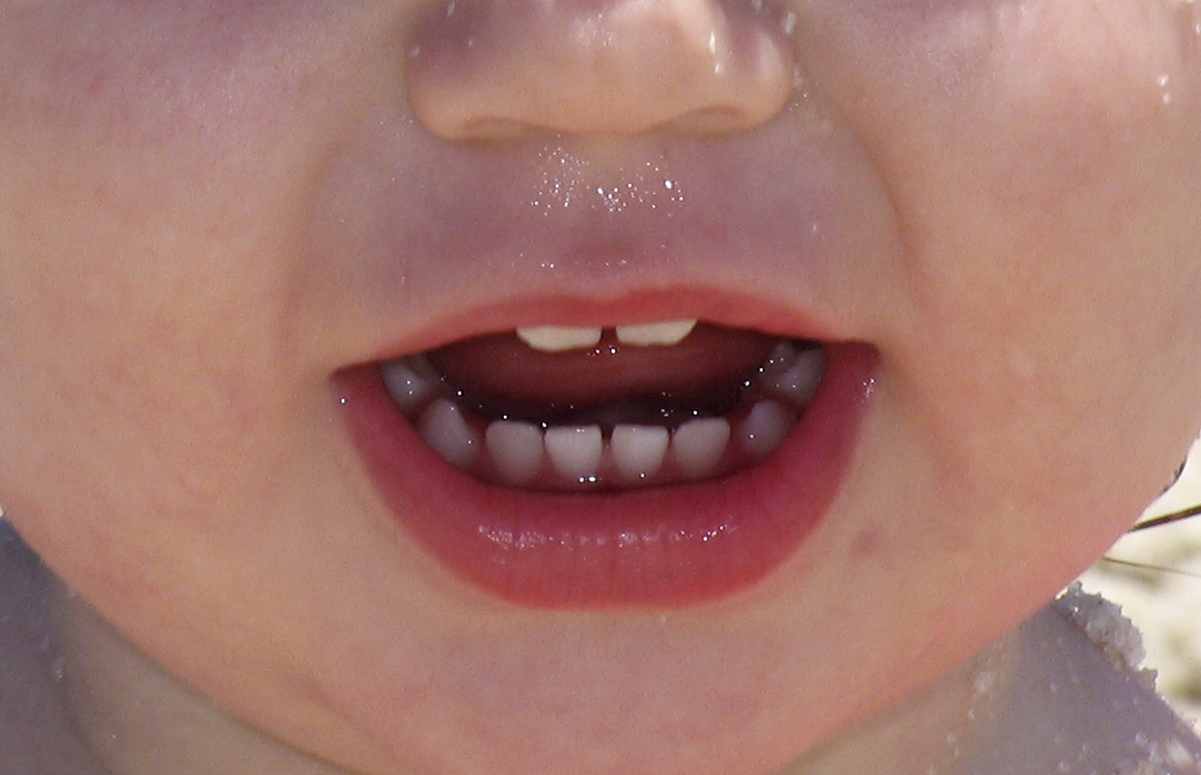 Babies Mouth 89